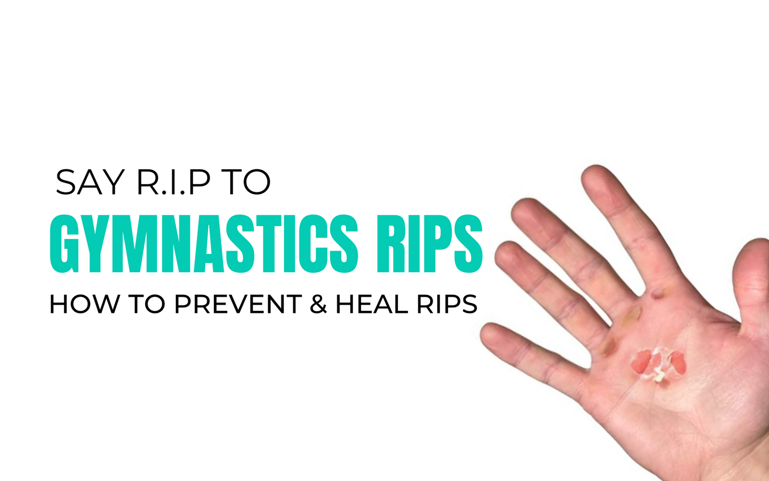 Say R.I.P to Gymnastics Rips – EMG Gymnastics